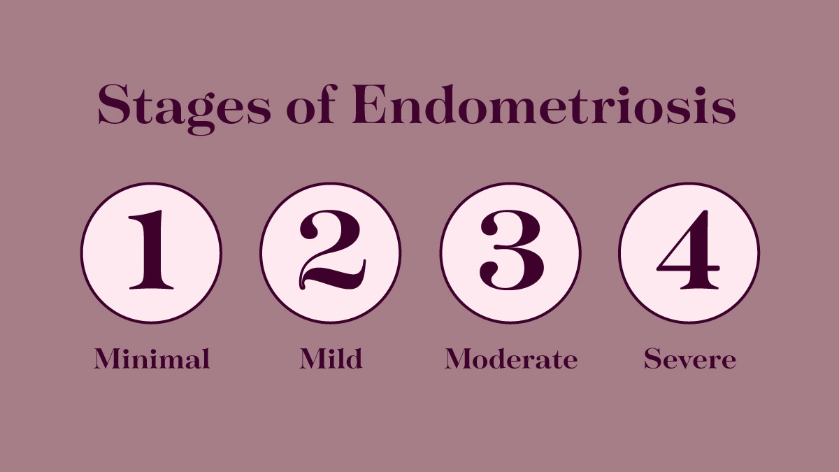 Endometriosis Symptoms Quiz | Do I Have Endometriosis?